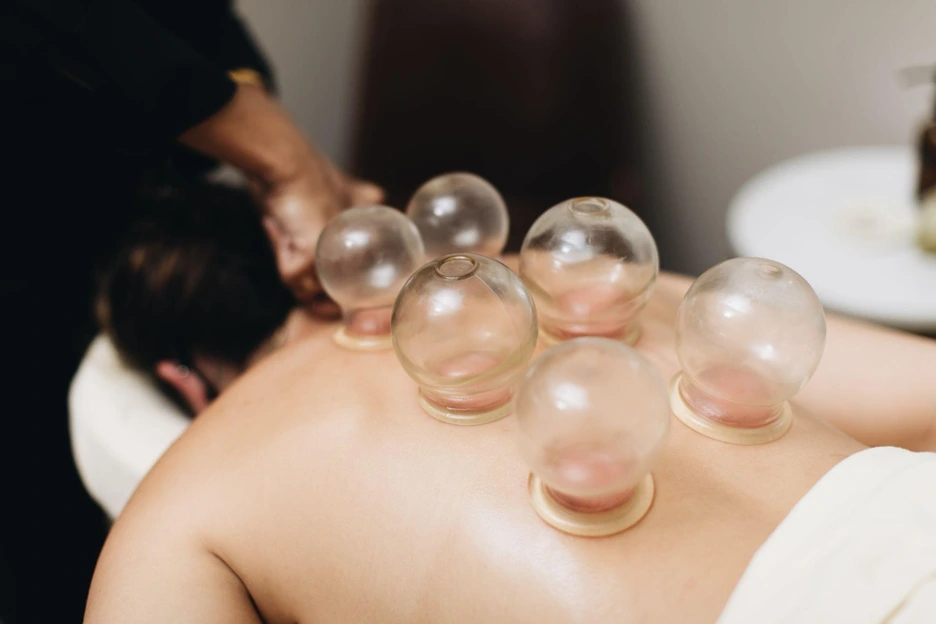 cupping therapy lincoln park