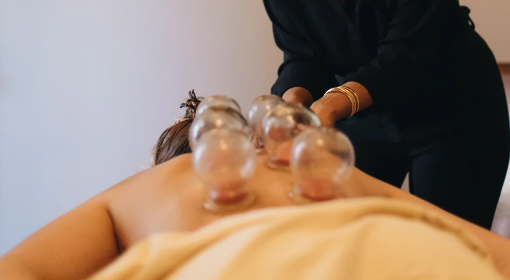 cupping therapy west town