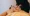 cupping therapy west town