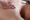 cupping therapy near me